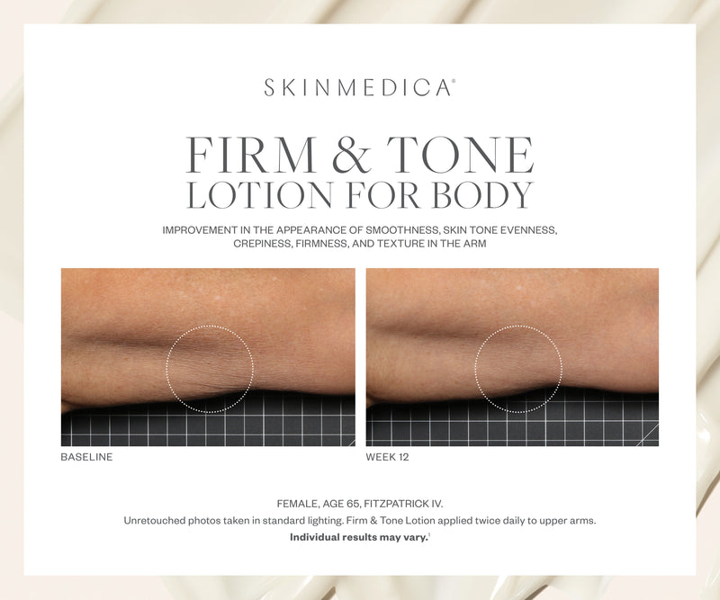 SkinMedica Firm and Tone Lotion for Body