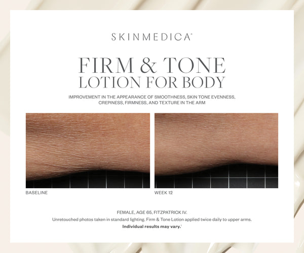 SkinMedica Firm and Tone Lotion for Body