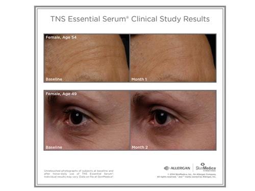 SkinMedica TNS Advanced + Serum